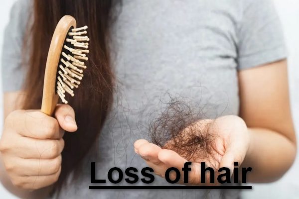 Loss of hair